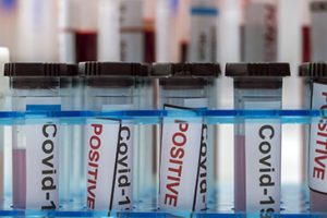 Vials with samples of SARS-COV-2 Covid-19 in a research laboratory, conceptual image Vials with samples of SARS-COV-2 Covid-19 in a research laboratory, conceptual image